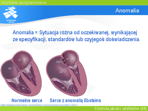 Anomalia