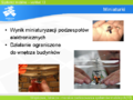 Miniatura wersji z 13:23, 28 sie 2006